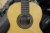 Cuenca Klassikgitarre 4/4 Modell 45 Ziricote - einmalige Holzstruktur